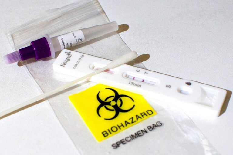 Italy: Sars - cov-2 Antigen Rapid Test, with positive result. Credit: Vincenzo Izzo/Alamy Live News