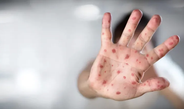 8e0331c9fccf0b7d9d835395def08412-2